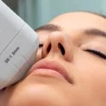 prestation HIfu visage et corps