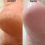 prestation beaute des pied a saint loubes