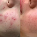 soins esthétiques avancés